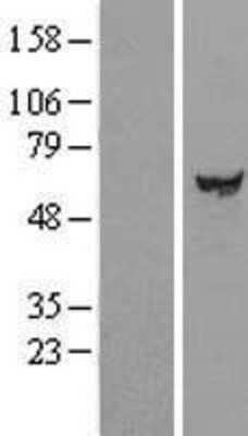 Western Blot: CCDC7 Overexpression Lysate [NBL1-08814]