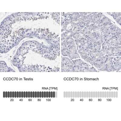 Immunocytochemistry/ Immunofluorescence: CCDC70 Antibody [NBP3-17100]