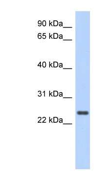 Western Blot: CCDC70 Antibody [NBP1-55305]