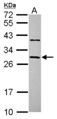 Western Blot: CCDC70 Antibody [NBP2-15754]