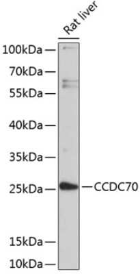 Western Blot: CCDC70 AntibodyBSA Free [NBP2-92739]