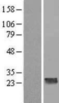 Western Blot: CCDC70 Overexpression Lysate [NBL1-08816]