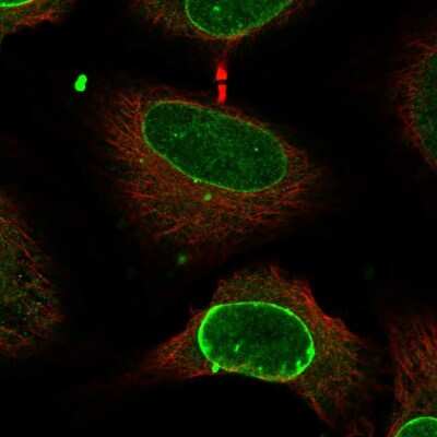 Immunocytochemistry/ Immunofluorescence: CCDC71 Antibody [NBP2-14600]