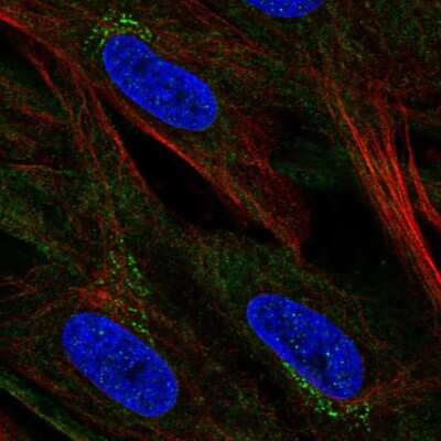 Immunocytochemistry/ Immunofluorescence: CCDC71L Antibody [NBP2-49536]