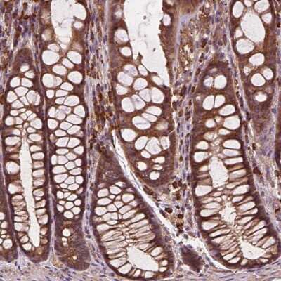 Immunohistochemistry-Paraffin: CCDC71L Antibody [NBP2-49536]