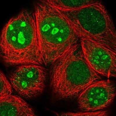 Immunocytochemistry/ Immunofluorescence: CCDC72 Antibody [NBP2-14594]