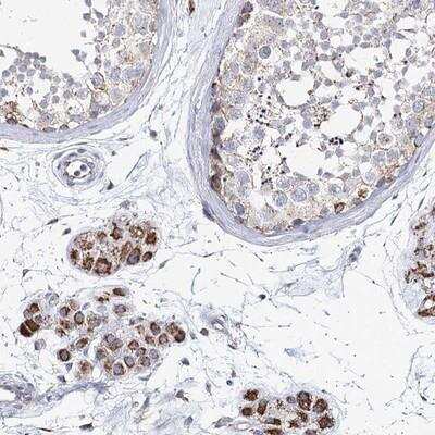 Immunohistochemistry: CCDC73 Antibody [NBP1-90689]