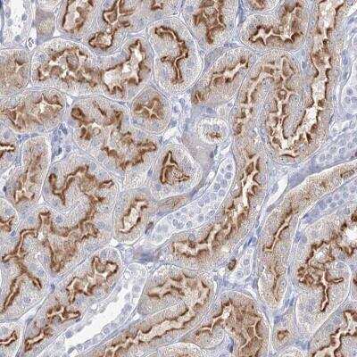 Immunohistochemistry: CCDC73 Antibody [NBP2-32641]