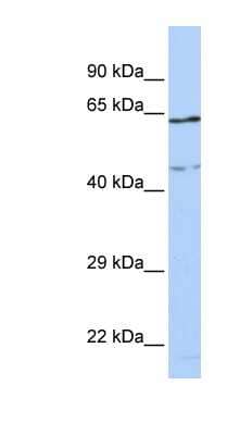 Western Blot: CCDC74A Antibody [NBP1-56895]