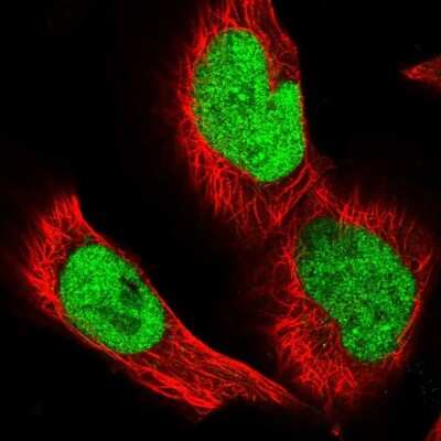 Immunocytochemistry/ Immunofluorescence: CCDC75 Antibody [NBP1-93801]