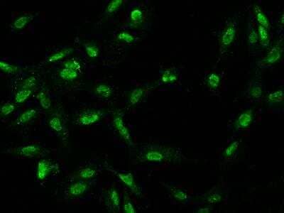 Immunocytochemistry/ Immunofluorescence: CCDC75 Antibody [NBP3-06106]