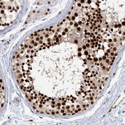 Immunohistochemistry: CCDC75 Antibody [NBP2-34044]