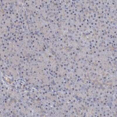 Immunohistochemistry-Paraffin: CCDC75 Antibody [NBP1-93801]