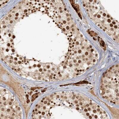 Immunohistochemistry-Paraffin: CCDC75 Antibody [NBP1-93801]