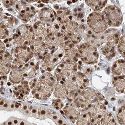 Immunohistochemistry-Paraffin: CCDC75 Antibody [NBP2-34044]
