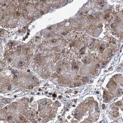 Immunohistochemistry-Paraffin: CCDC75 Antibody [NBP2-34044]