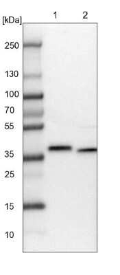Western Blot: CCDC75 Antibody [NBP1-93801]