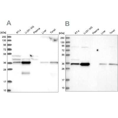 Western Blot: CCDC75 Antibody [NBP1-93801]