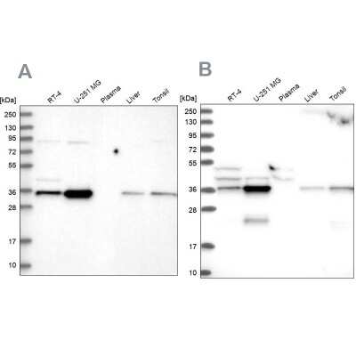 Western Blot: CCDC75 Antibody [NBP2-34044]