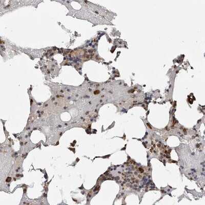 Immunohistochemistry-Paraffin: CCDC76 Antibody [NBP1-84643]