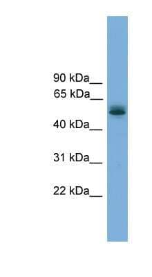 Western Blot: CCDC76 Antibody [NBP1-57022]