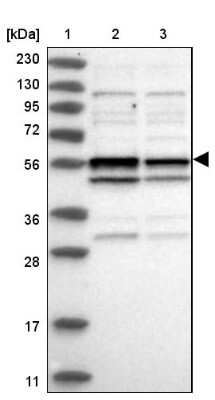 Western Blot: CCDC76 Antibody [NBP1-84643]