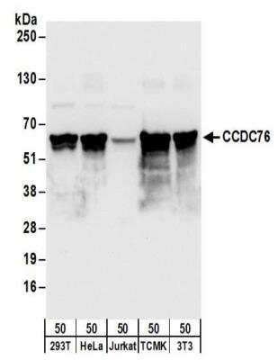 Western Blot: CCDC76 Antibody [NBP2-32177]