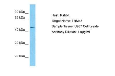 Western Blot: CCDC76 Antibody [NBP2-87153]