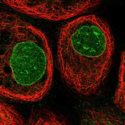 Immunocytochemistry/ Immunofluorescence: CCDC77 Antibody [NBP1-93521]