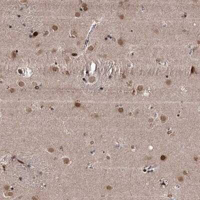 Immunohistochemistry-Paraffin: CCDC77 Antibody [NBP1-93521]