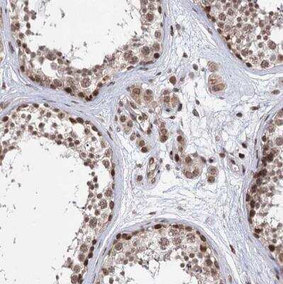 Immunohistochemistry-Paraffin: CCDC77 Antibody [NBP1-93521]