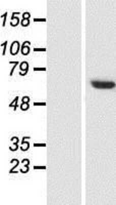 Western Blot: CCDC77 Overexpression Lysate [NBP2-06043]