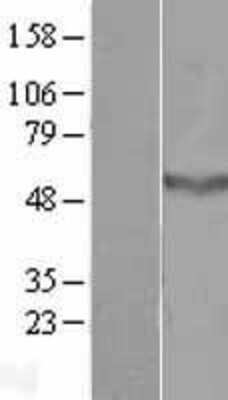 Western Blot: CCDC78 Overexpression Lysate [NBL1-08823]