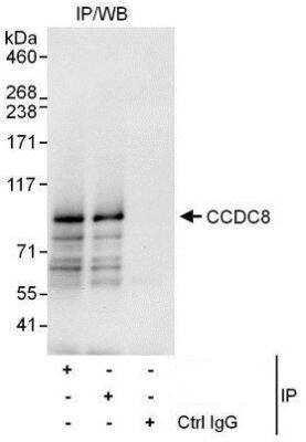 Immunoprecipitation: CCDC8 Antibody [NBP1-50022]