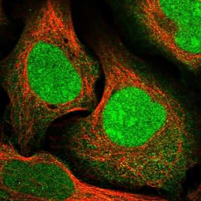 Immunocytochemistry/ Immunofluorescence: CCDC82 Antibody [NBP1-83583]