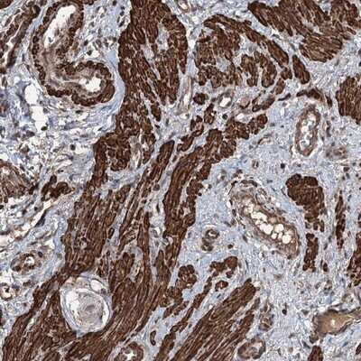 Immunohistochemistry-Paraffin: CCDC82 Antibody [NBP1-83583]