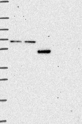 Western Blot: CCDC82 Antibody [NBP3-17223]