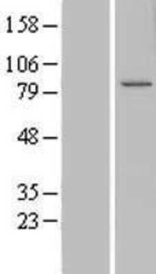 Western Blot: CCDC82 Overexpression Lysate [NBL1-08825]