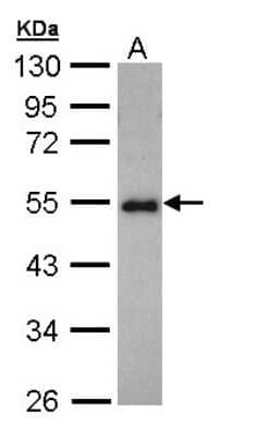 Western Blot: CCDC83 Antibody [NBP1-32738]