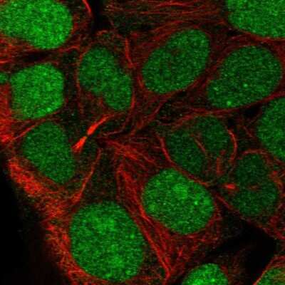 Immunocytochemistry/ Immunofluorescence: CCDC84 Antibody [NBP2-57702]