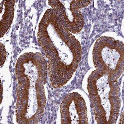 Immunohistochemistry: CCDC84 Antibody [NBP2-14456]