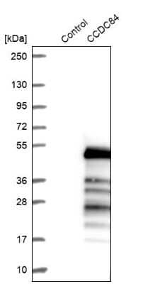 Western Blot: CCDC84 Antibody [NBP2-14456]