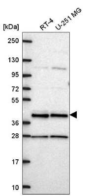 Western Blot: CCDC84 Antibody [NBP2-57702]