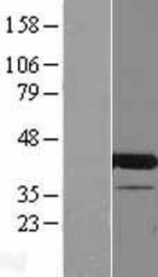 Western Blot: CCDC84 Overexpression Lysate [NBP2-04697]