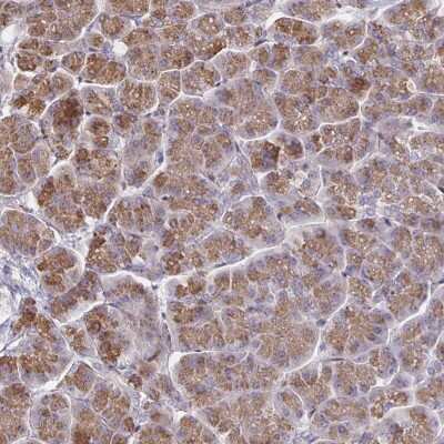 Immunohistochemistry: CCDC85A Antibody [NBP2-49241]