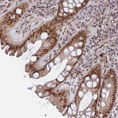 Immunohistochemistry-Paraffin: CCDC85A Antibody [NBP1-93565]