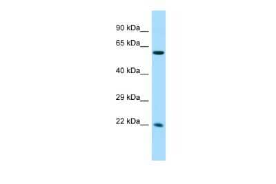 Western Blot: CCDC85A Antibody [NBP2-84626]