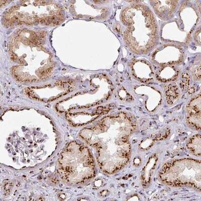 Immunohistochemistry-Paraffin: CCDC85B Antibody [NBP2-14457]