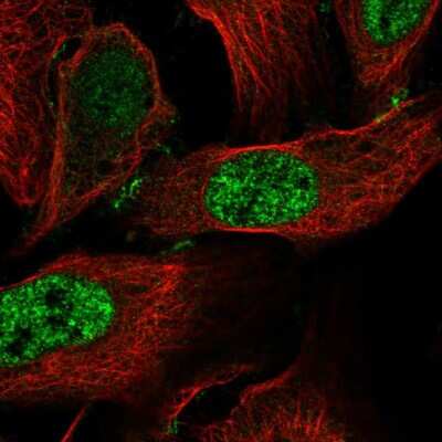 Immunocytochemistry/ Immunofluorescence: CCDC85C Antibody [NBP2-34194]