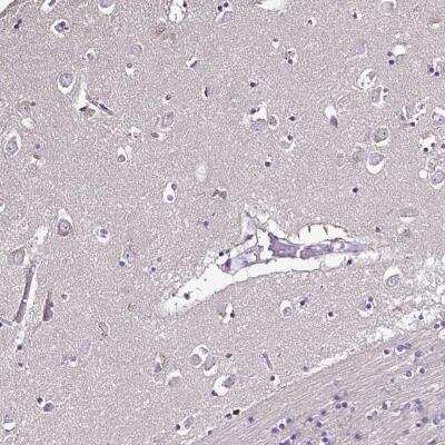 Immunohistochemistry-Paraffin: CCDC85C Antibody [NBP2-34194]